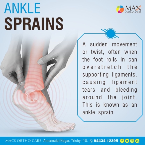 Ankle Sprain