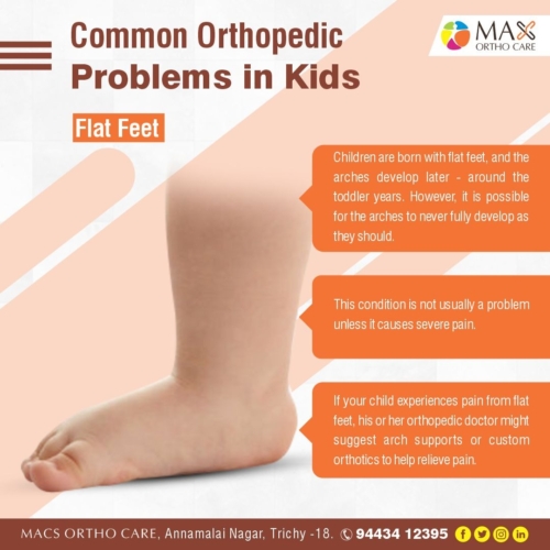 Flat Feet